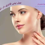 جراحی بینی فانتزی