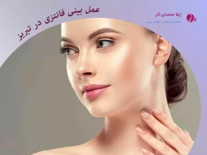 جراحی بینی فانتزی