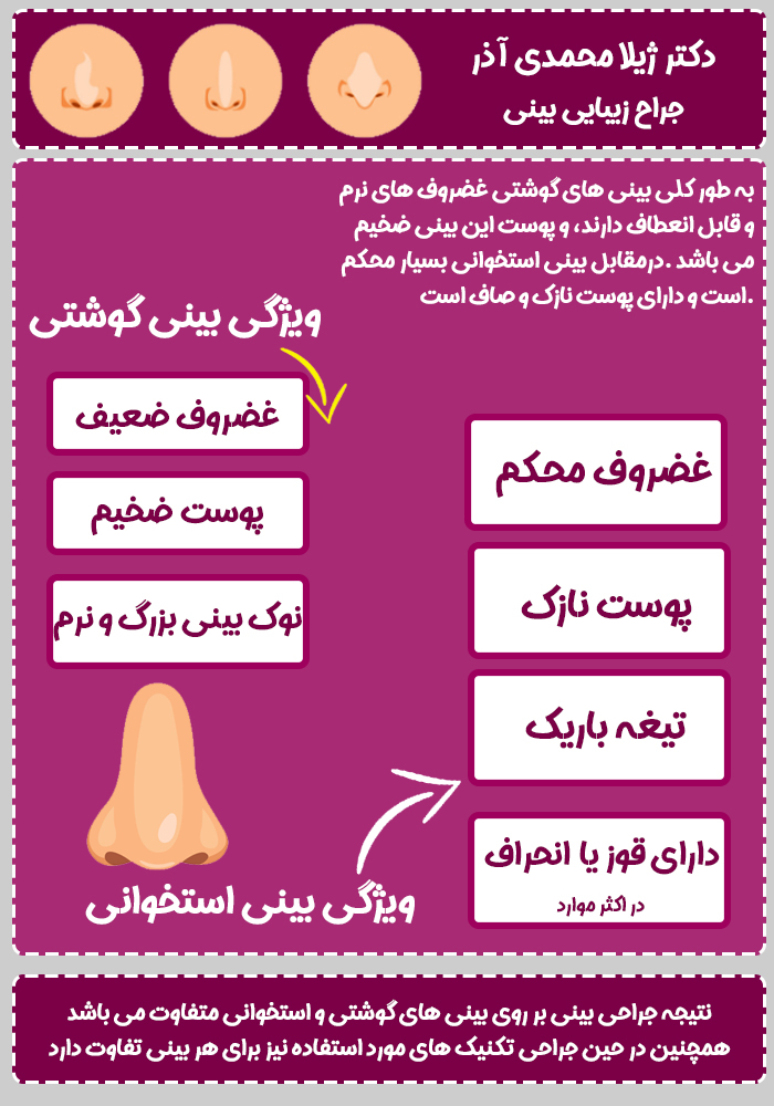 عکس بینی وکتور