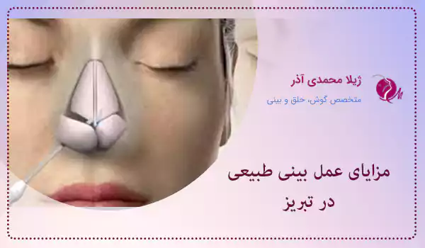 مزایای عمل بینی طبیعی در تبریز