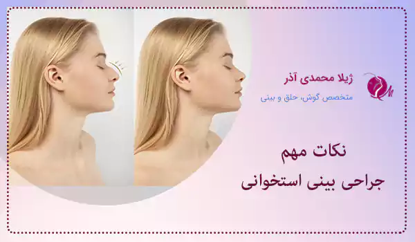 نکات مهم جراحی بینی استخوانی