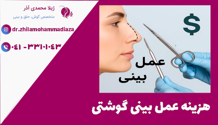 هزینه عمل بینی گوشتی