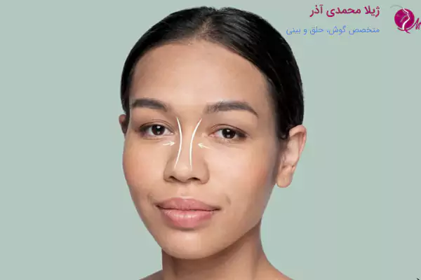 تاثیر دستمزد جراح بر هزینه عمل بینی گوشتی در تبریز