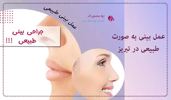 عمل بینی به صورت طبیعی در تبریز