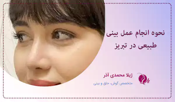 نحوه انجام عمل بینی طبیعی در تبریز