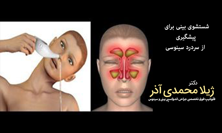 شستشوی بینی برای
