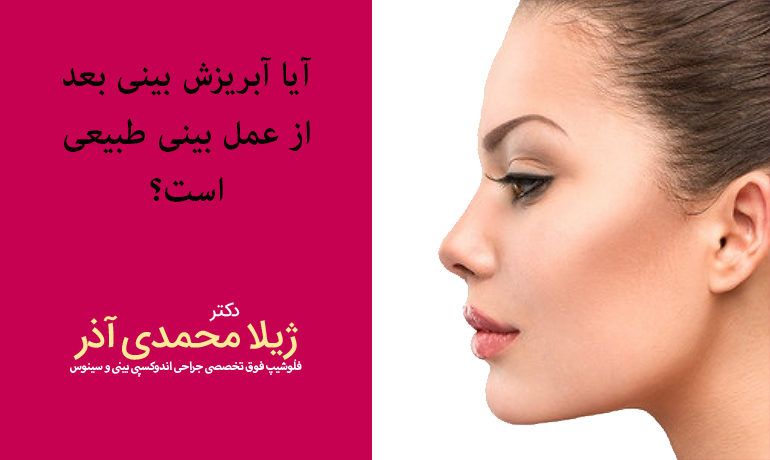آبریزش بینی بعد از عمل بینی