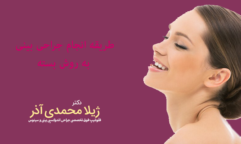 طریقه انجام جراحی بینی به روش بسته