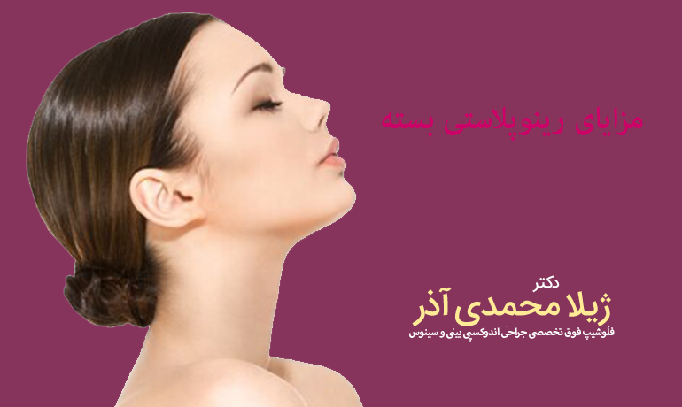 مزایای رینوپلاستی بسته