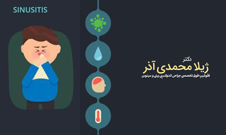 سینوزیت کودکان