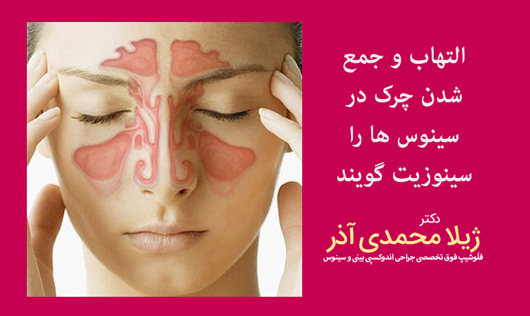 التهاب و جمع شدن چرک در سینوس را سینوزیت گویند