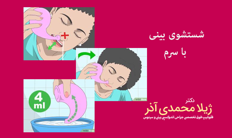 شستشوی بینی