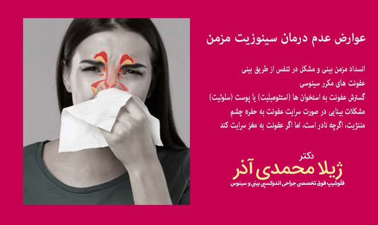 عوارض سینوزیت مزمن