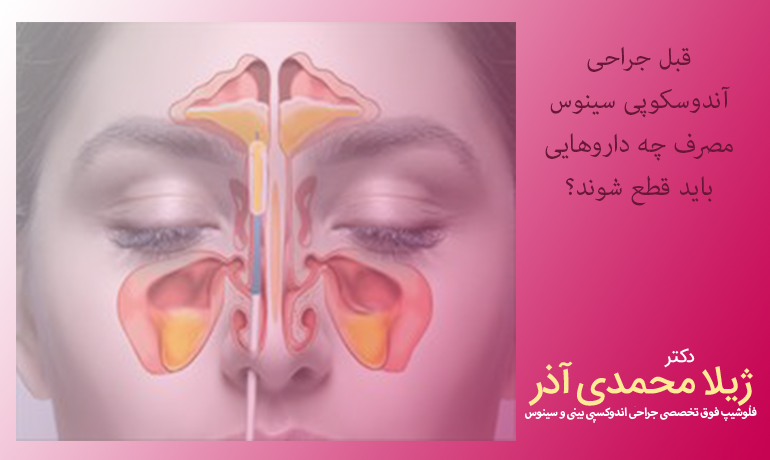 قبل جراحی آندوسکوپی سینوس مصرف چه داروهایی باید قطع شوند؟