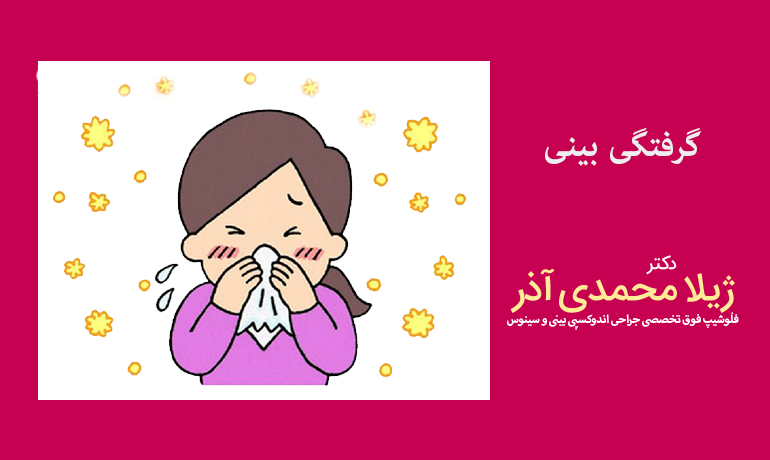 گرفتگی بینی