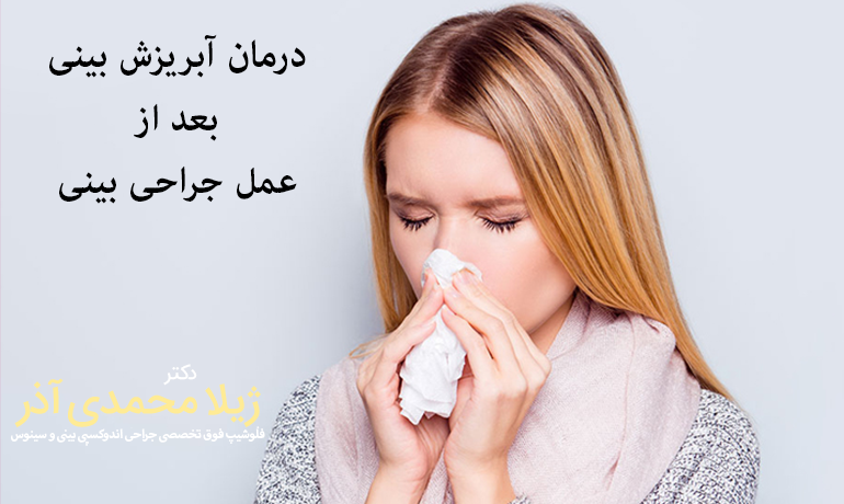 درمان آبریزش بینی بعد از عمل جراحی