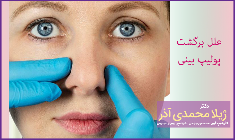 دلایل برگشت پولیپ بینی بعد از جراحی
