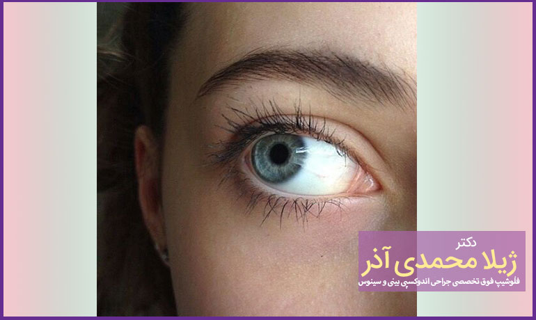 استفاده-از-قطره‌ها-و-پمادهای-چشمی