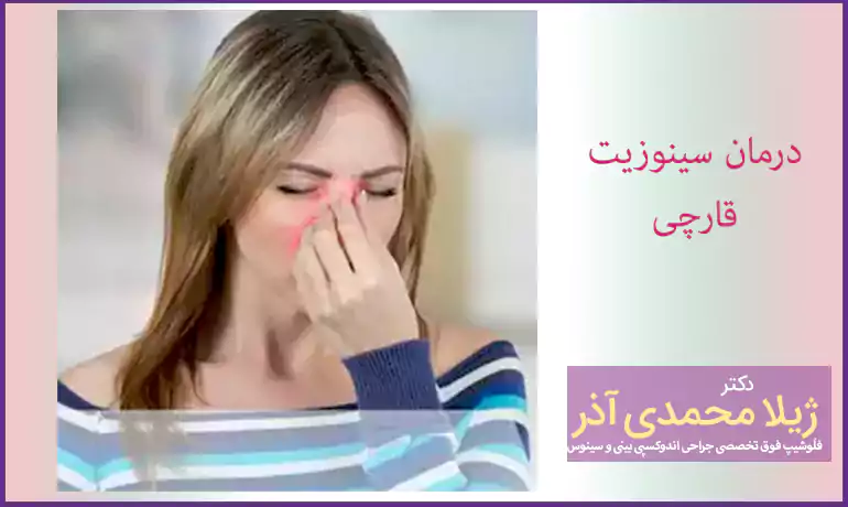 درمان سینوزیت قارچی