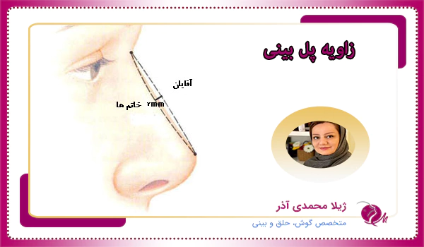 زاویه پل بینی