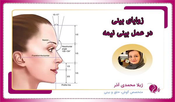 زوایای بینی در عمل بینی نیمه فانتزی