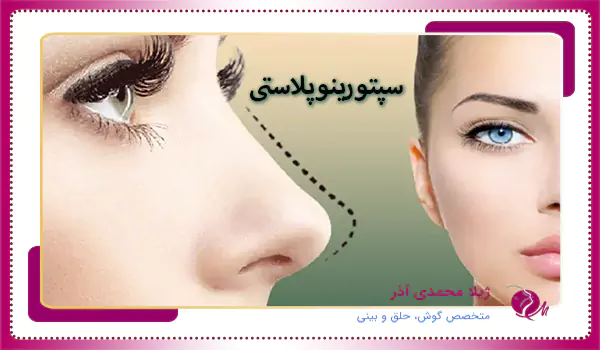 سپتورینوپلاستی