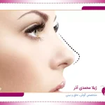 عمل بینی نیمه فانتزی