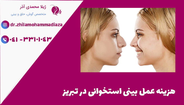 هزینه عمل بینی استخوانی در تبریز