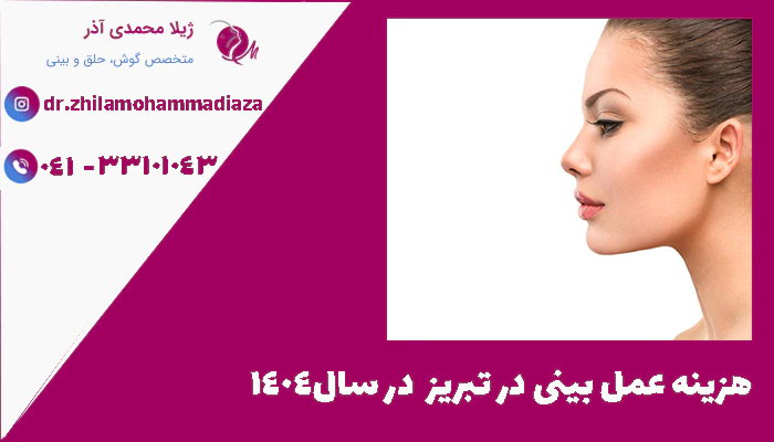 هزینه عمل بینی در تبریز  در سال1404