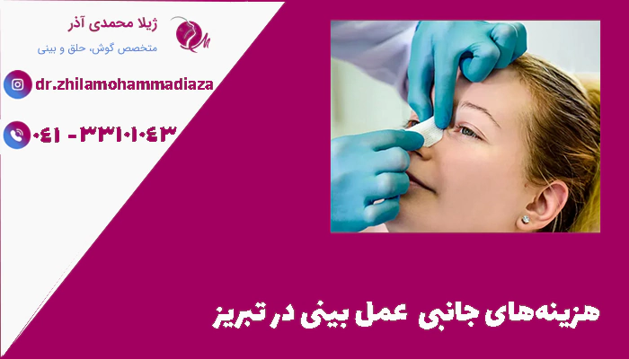 هزینه‌های جانبی  عمل بینی در تبریز