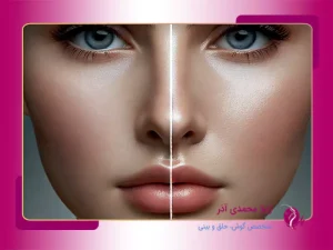 تیپ پلاستی در تبریز