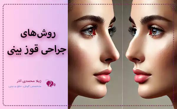 روش‌های جراحی قوز بینی