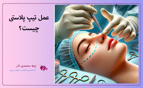 عمل تیپ پلاستی چیست؟