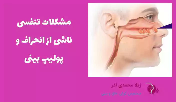 مشکلات تنفسی ناشی از انحراف و پولیپ بینی