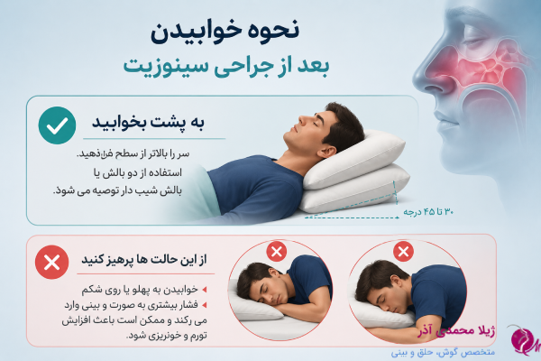خوابیدن بعد از جراحی سینوزیت