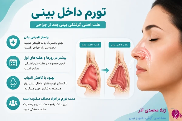 تورم داخل بینی