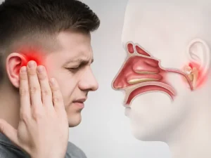 آیا سینوزیت باعث گوش درد میشود و ارتباط آن با درد گوش